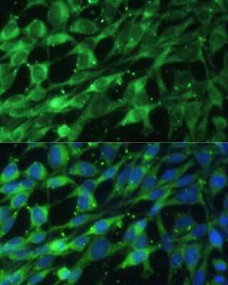 Immunocytochemistry/ Immunofluorescence: BLOS3 Antibody - BSA Free [NBP3-03343]