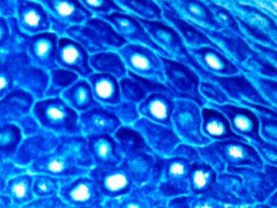 Immunohistochemistry-Paraffin: BLUE AP Plus Staining Kit (Colorimetric) [NBP3-12171]