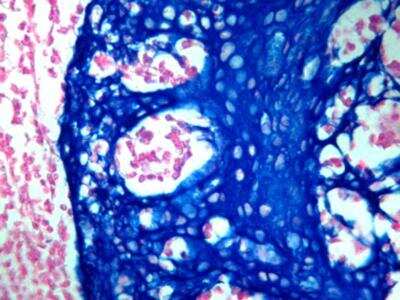 Immunohistochemistry-Paraffin: BLUE HRP Staining Kit (Colorimetric) [NBP3-12182]