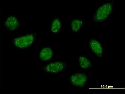 Immunocytochemistry/ Immunofluorescence: BLZF1 Antibody [H00008548-B01P]