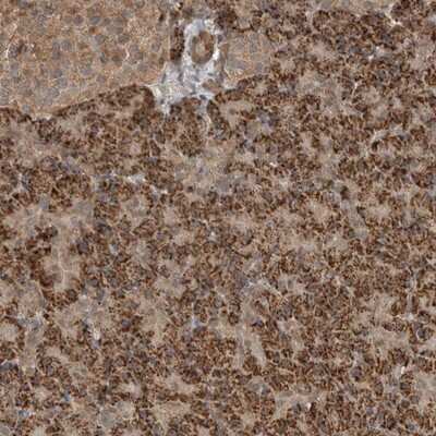 Immunohistochemistry-Paraffin: BLZF1 Antibody [NBP1-83082]