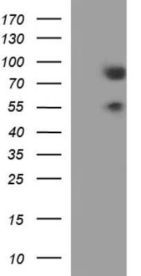 Western Blot: BMAL1 Antibody (OTI1H6) [NBP2-46544]