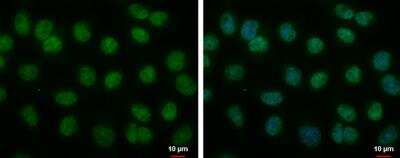 Immunocytochemistry/ Immunofluorescence: BMAL1 Antibody [NBP2-15599]