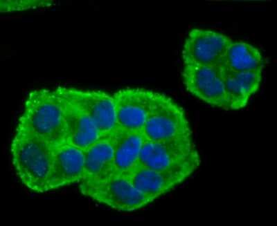 Immunocytochemistry/ Immunofluorescence: BMAL1 Antibody (JM17-34) [NBP2-67191]