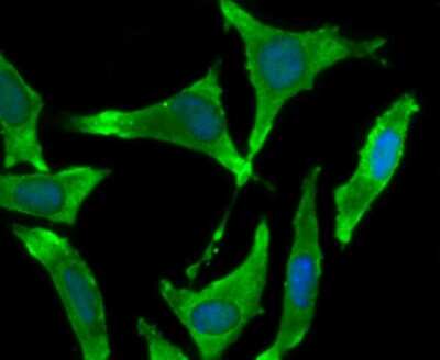 Immunocytochemistry/ Immunofluorescence: BMAL1 Antibody (JM17-34) [NBP2-67191]