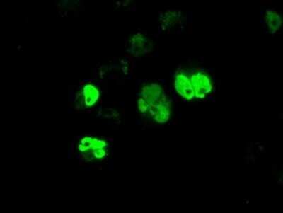 Immunocytochemistry/ Immunofluorescence: BMAL1 Antibody (OTI1C11) - Azide and BSA Free [NBP2-70207]