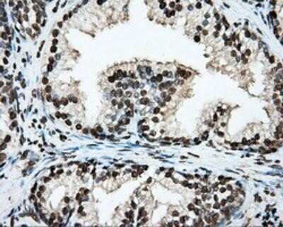 Immunohistochemistry: BMAL1 Antibody (OTI1C11) - Azide and BSA Free [NBP2-70207]
