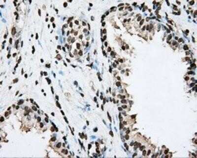 Immunohistochemistry-Paraffin: BMAL1 Antibody (OTI1C11) [NBP2-02544]