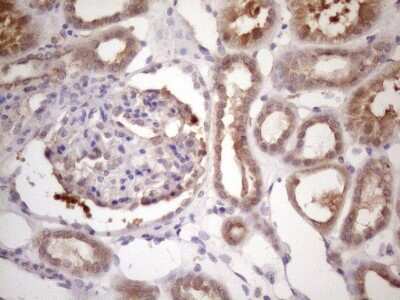 Immunohistochemistry: Bmf Antibody (OTI6F3) [NBP2-46578]
