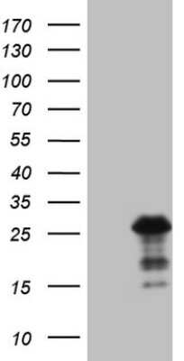 Western Blot: Bmf Antibody (OTI6F3) [NBP2-46578]