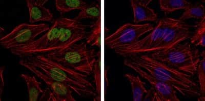 Immunocytochemistry/ Immunofluorescence: BMI-1 Antibody (3E3) - BSA Free [NBP2-22204]