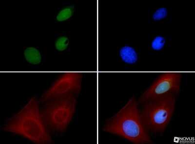Immunocytochemistry/ Immunofluorescence: BMI-1 Antibody (LLBmi1-1) - BSA Free [NBP1-96140]