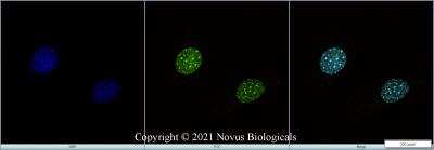 Immunocytochemistry/ Immunofluorescence: BMI-1 Antibody (LLBmi1-1) - BSA Free [NBP1-96140]