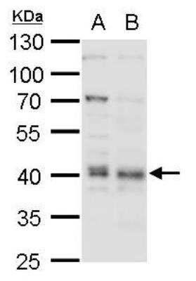 Western Blot: BMI-1 Antibody [NBP1-33748]