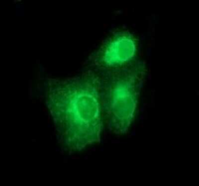 Immunocytochemistry/ Immunofluorescence: BMP-1/PCP Antibody (OTI3E9) [NBP2-46579]