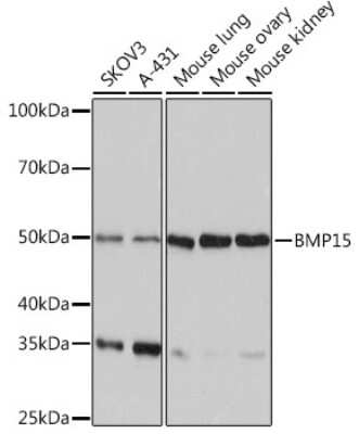 Western Blot: BMP-15/GDF-9B Antibody (6K5C3) [NBP3-16342]