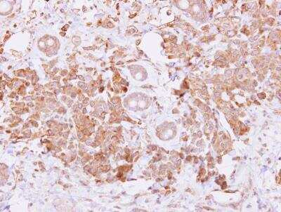 Immunohistochemistry-Paraffin: BMP-15/GDF-9B Antibody [NBP2-14888]