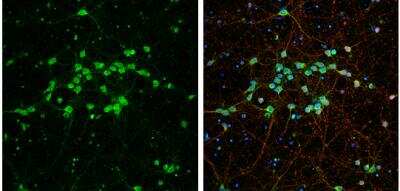 Immunocytochemistry/ Immunofluorescence: BMP-3b/GDF-10 Antibody [NBP2-16630]