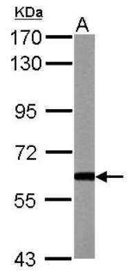 Western Blot: BMP-3b/GDF-10 Antibody [NBP2-16630]