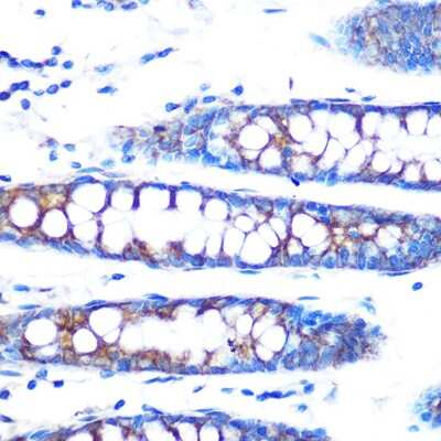 Immunohistochemistry-Paraffin: BMP-4 Antibody (7Q2U7) [NBP3-15376]