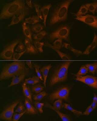 Immunocytochemistry/ Immunofluorescence: BMP-6 Antibody (6N5S9) [NBP3-16430]