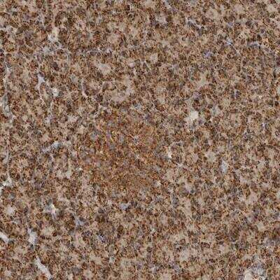 Immunohistochemistry: BMP2K Antibody [NBP1-88603]