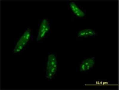 Immunocytochemistry/ Immunofluorescence: BMP2K Antibody (X1) [H00055589-M03]