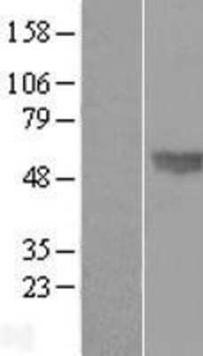 Western Blot: BMP-4 Overexpression Lysate [NBP2-09771]
