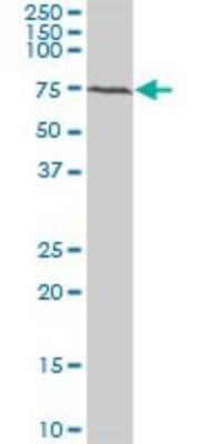 Western Blot: BMPR-IB/ALK-6 Antibody (2E2) [H00000658-M07]