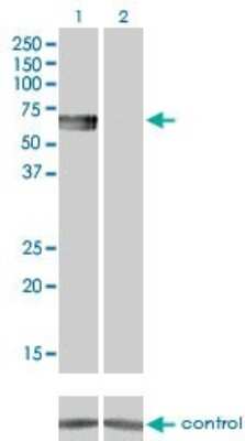 Western Blot: BMPR-IB/ALK-6 Antibody (2F3) [H00000658-M01]