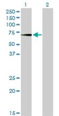 Western Blot: BMPR-IB/ALK-6 Antibody (2F3) [H00000658-M01]