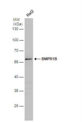 Western Blot: BMPR-IB/ALK-6 Antibody [NBP2-14889]