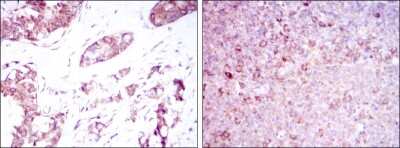 Immunohistochemistry-Paraffin: BMPR-II Antibody (1F12) - BSA Free [NBP2-37625]