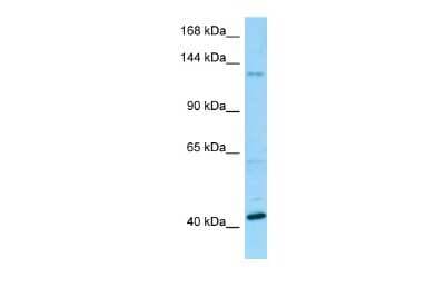 Western Blot: BMS1 Antibody [NBP2-82764]
