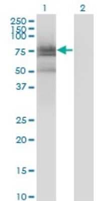 Western Blot: BMX Antibody (3G3) [H00000660-M01]