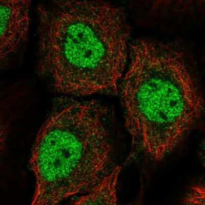 Immunocytochemistry/ Immunofluorescence: BNC1 Antibody [NBP2-57360]