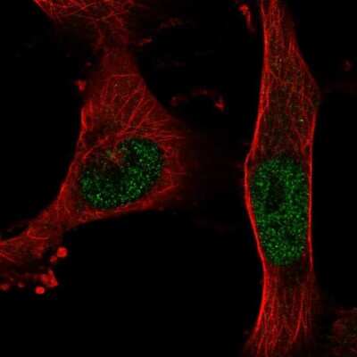 Immunocytochemistry/ Immunofluorescence: BNC2 Antibody [NBP2-68753]