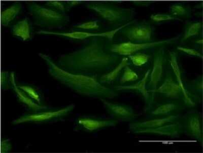 Immunocytochemistry/ Immunofluorescence: BNIP1 Antibody (1G7) [H00000662-M01]