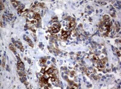 Immunohistochemistry: BNIP1 Antibody (OTI2B3) - Azide and BSA Free [NBP2-70257]
