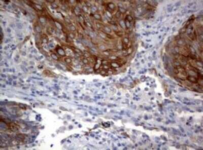 Immunohistochemistry: BNIP1 Antibody (OTI2B3) - Azide and BSA Free [NBP2-70257]