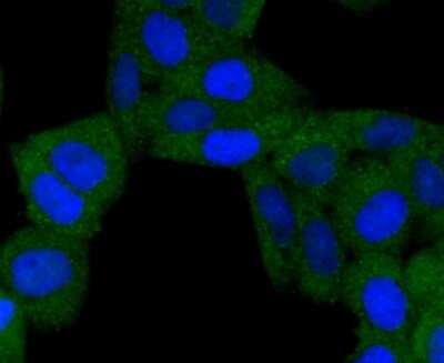 Immunocytochemistry/ Immunofluorescence: BNIP3 Antibody (JA71-10) [NBP2-67192]