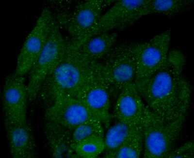 Immunocytochemistry/ Immunofluorescence: BNIP3 Antibody (JA71-10) [NBP2-67192]