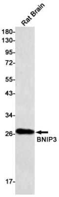 Western Blot: BNIP3 Antibody (S09-1G8) [NBP3-19550]