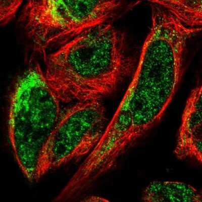 Immunocytochemistry/ Immunofluorescence: BNIP3L Antibody [NBP1-88558]