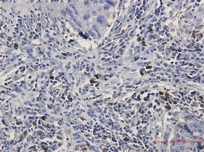 Immunohistochemistry-Paraffin: BNIP3L Antibody (S01-0F5) [NBP3-19585]