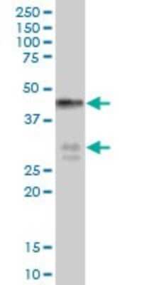 Western Blot: BNIPL Antibody [H00149428-B01P]