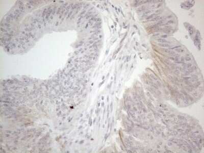 Immunohistochemistry: NT-proBNP Antibody (OTI11G4) [NBP2-46201]