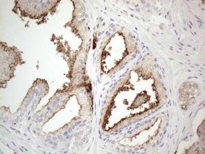 Immunohistochemistry: NT-proBNP Antibody (OTI11G4) [NBP2-46201]