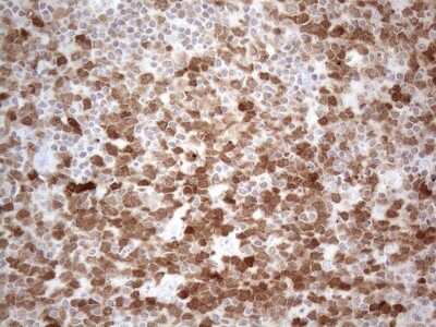Immunohistochemistry: BOB1 Antibody (OTI2D4) [NBP2-45374]