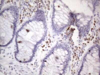 Immunohistochemistry: BOB1 Antibody (OTI2D4) [NBP2-45374]